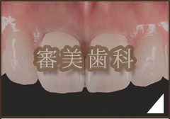 審美歯科