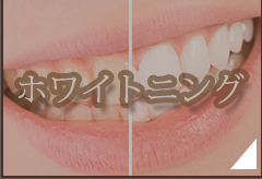 ホワイトニング